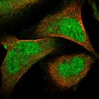 Immunofluorescent staining of human cell line U-2 OS shows localization to nucleoplasm & cytosol.