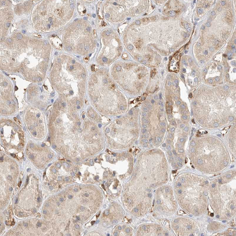 Anti-JMJD4 Antibody