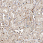 Anti-JMJD4 Antibody