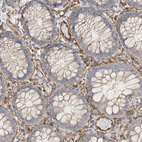 Immunohistochemical staining of human colon shows strong cytoplasmic positivity in endothelial cells and weak cytoplasmic positivity in glandular cells.
