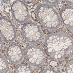 Immunohistochemical staining of human colon shows strong cytoplasmic positivity in endothelial cells and weak cytoplasmic positivity in glandular cells.
