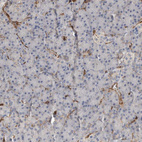 Anti-JMJD4 Antibody