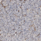 Immunohistochemical staining of human pancreas shows strong cytoplasmic positivity in endothelial cells and weak cytoplasmic positivity in exocrine glandular cells.