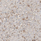 Immunohistochemical staining of human liver shows strong cytoplasmic positivity in endothelial cells.