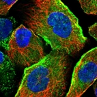 Immunofluorescent staining of human cell line A-431 shows localization to plasma membrane & vesicles.