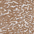 Anti-CERS2 Antibody