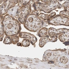 Immunohistochemical staining of human placenta shows moderate cytoplasmic positivity in trophoblastic cells.