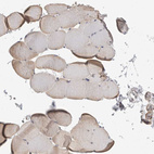 Immunohistochemical staining of human skeletal muscle shows only weak cytoplasmic positivity in striated muscle fibers as expected.