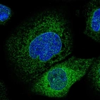 Immunofluorescent staining of human cell line A-431 shows localization to nuclear membrane & endoplasmic reticulum.