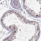 Immunohistochemical staining of human testis shows high expression.
