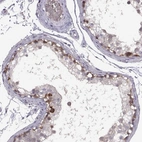 Immunohistochemical staining of human testis shows high expression.