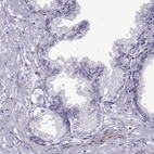 Immunohistochemical staining of human prostate shows low expression as expected.
