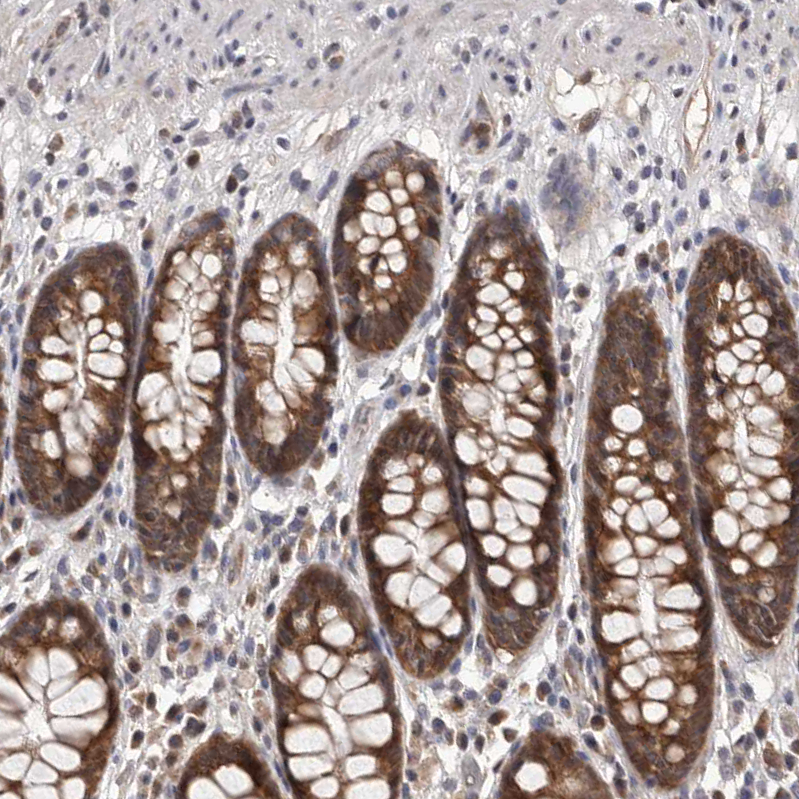 Anti-MAP3K14 Antibody