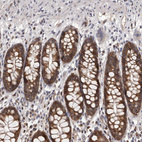 Anti-MAP3K14 Antibody