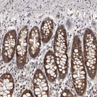Anti-MAP3K14 Antibody