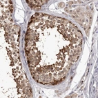 Immunohistochemical staining of human testis shows moderate to strong cytoplasmic positivity in cells in seminiferous ducts.