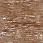 Immunohistochemical staining of human skeletal muscle shows strong cytoplasmic positivity in myocytes.