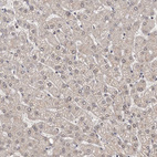 Immunohistochemical staining of human liver shows negative to very weak positivity in hepatocytes.