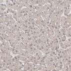 Anti-MAP3K14 Antibody