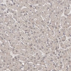 Immunohistochemical staining of human liver shows negative to very weak positivity in hepatocytes.