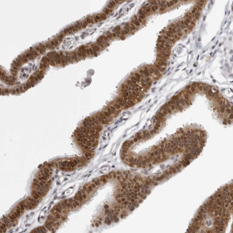 Anti-WDR77 Antibody