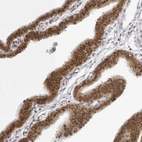 Anti-WDR77 Antibody