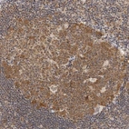 Immunohistochemical staining of human lymph node shows moderate cytoplasmic positivity in germinal center cells.
