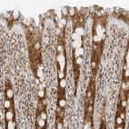 Immunohistochemical staining of human rectum shows weak to moderate cytoplasmic and nuclear positivity in glandular cells.
