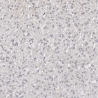 Immunohistochemical staining of human liver shows no positivity in hepatocytes as expected.