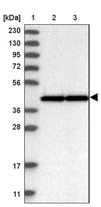 Lane 1: Marker [kDa] 230, 130, 95, 72, 56, 36, 28, 17, 11_br/_Lane 2: Human cell line RT-4_br/_Lane 3: Human cell line U-251MG sp