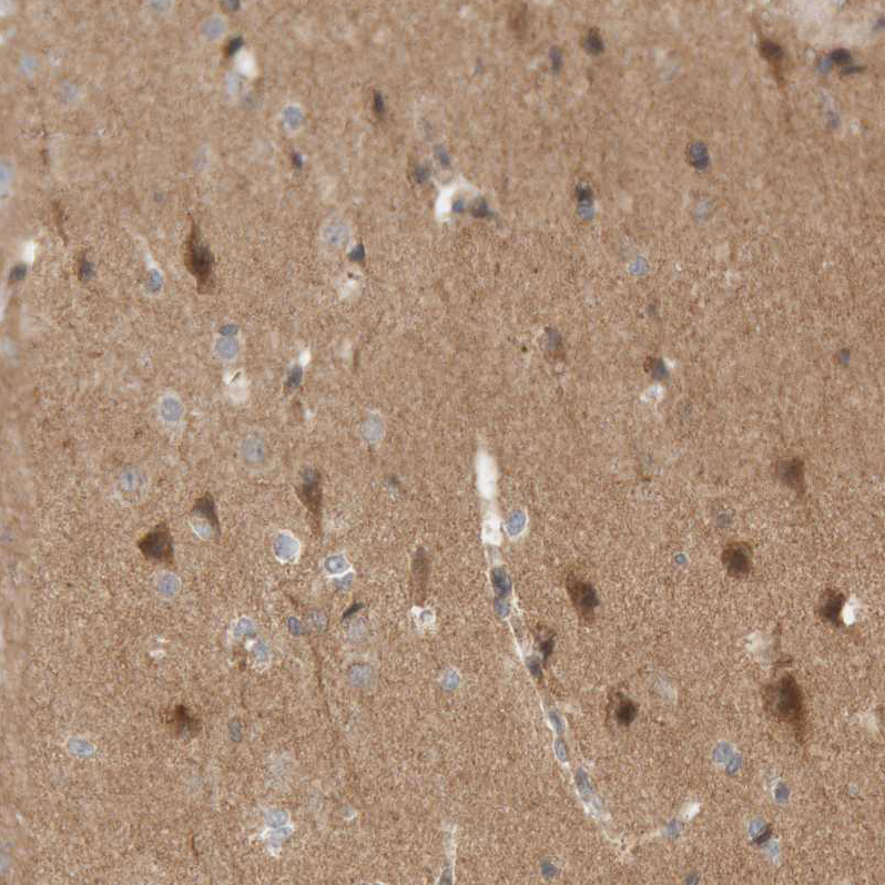 Anti-KIF21B Antibody