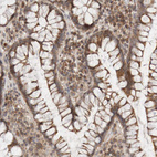 Immunohistochemical staining of human colon shows moderate to strong cytoplasmic positivity in glandular cells.