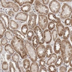 Immunohistochemical staining of human kidney shows moderate to strong cytoplasmic positivity in cells in tubules.