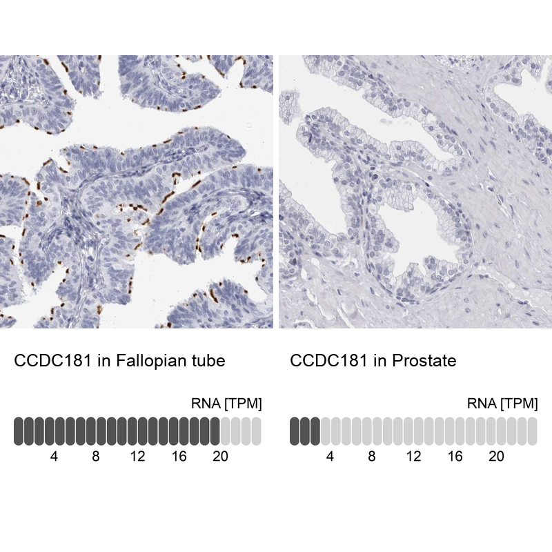 Anti-CCDC181 Antibody