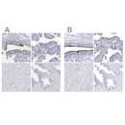 Immunohistochemical staining of human bronchus, fallopian tube, liver and prostate using Anti-CCDC181 antibody HPA027275 (A) shows similar protein distribution across tissues to independent antibody HPA027189 (B).