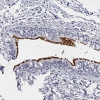 Immunohistochemical staining of human bronchus shows strong positivity in respiratory epithelial cells.