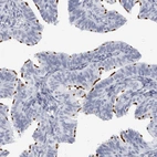 Immunohistochemical staining of human Fallopian tube shows strong positivity in cilia in glandular cells.