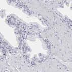Immunohistochemical staining of human prostate shows no positivity in glandular cells as expected.