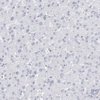 Immunohistochemical staining of human liver shows no positivity in hepatocytes as expected.