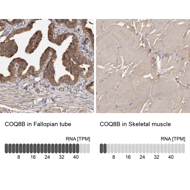 Anti-COQ8B Antibody