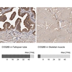 Anti-COQ8B Antibody