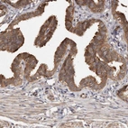 Immunohistochemical staining of human fallopian tube shows high expression.
