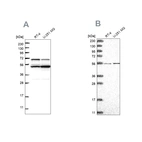 Western blot analysis using Anti-COQ8B antibody HPA027279 (A) shows similar pattern to independent antibody HPA028303 (B).
