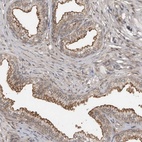 Anti-ABL1 Antibody