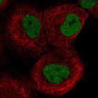 Immunofluorescent staining of human cell line A-431 shows localization to nucleoplasm & nuclear bodies.