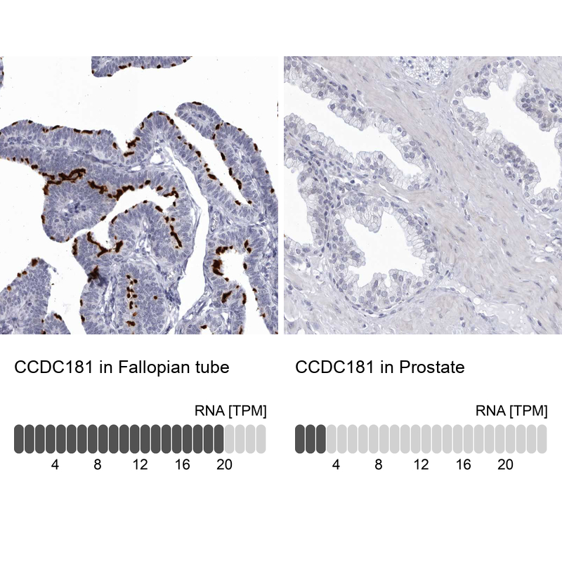 Anti-CCDC181 Antibody