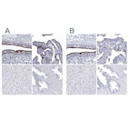 Immunohistochemical staining of human bronchus, fallopian tube, liver and prostate using Anti-CCDC181 antibody HPA027281 (A) shows similar protein distribution across tissues to independent antibody HPA027189 (B).