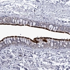 Immunohistochemical staining of human bronchus shows strong positivity in respiratory epithelial cells.