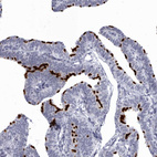 Anti-CCDC181 Antibody