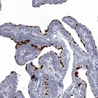 Immunohistochemical staining of human Fallopian tube shows strong positivity in cilia in glandular cells.